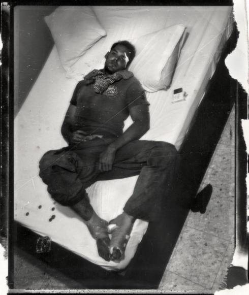 Photo: Philip Blenkinsop. I had numerous injuries, including blown eardrums, bones sticking out of my legs, shrapnel in my head torso, and legs, several broken bones, and a dislocated kidney. I also had what would be permanent brain damage